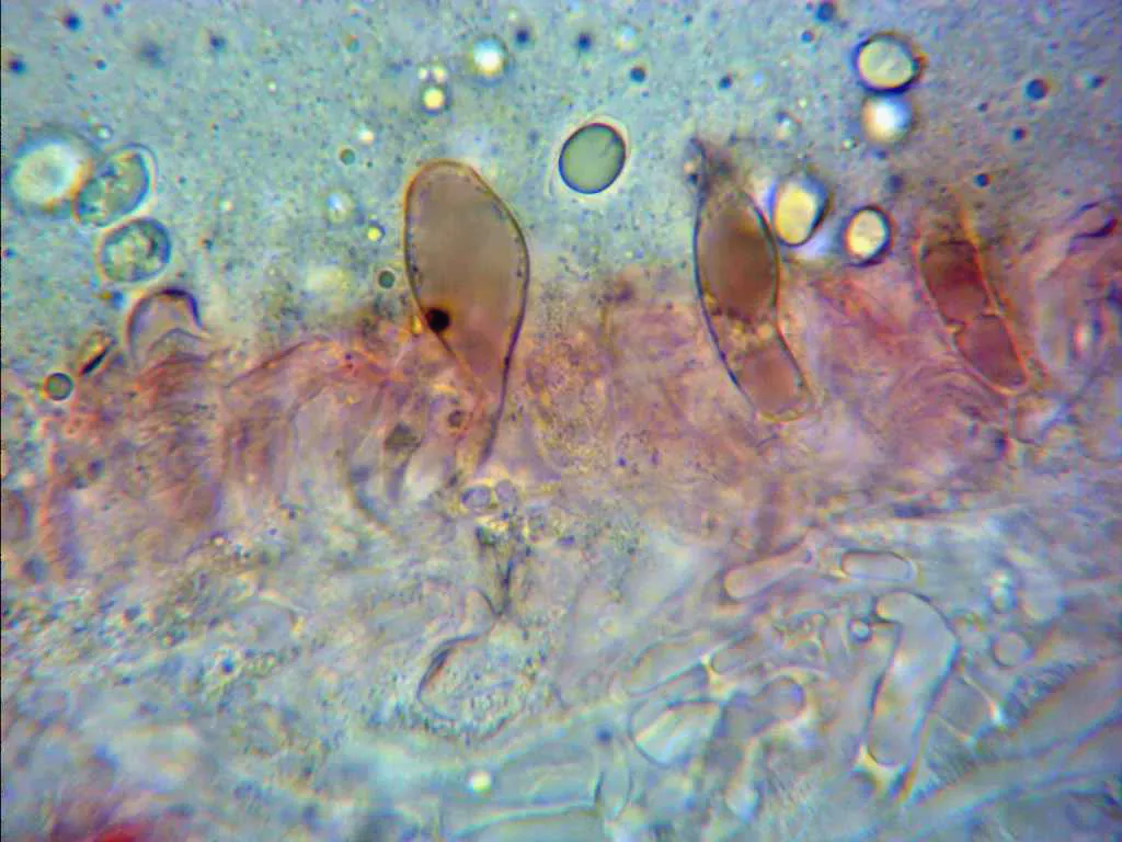 Microscopía de Mycena seynii - 21 - Queilocistidios